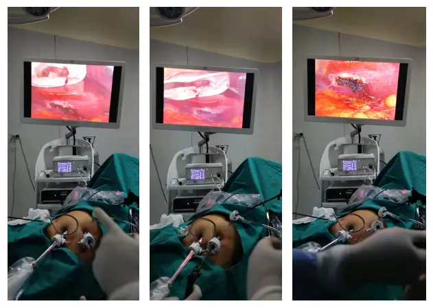 operaciones-com-torre-de-cirugia-marca-vims-hospital-espinar-cuzco